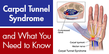 cc_carpaltunnelsyndrome_webinarthumbnail_0921
